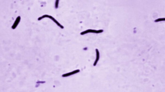 Wybuchy gruźlicy pojawiają się, gdy nielegalne stanowią zagrożenie dla bezpieczeństwa biologicznego dla narodu