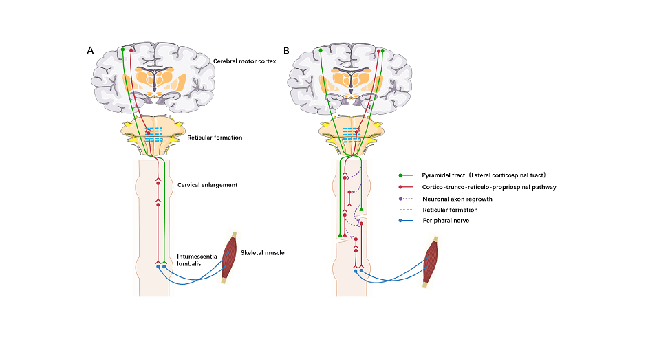 Naukowcy Pioneer Fusion Method do naprawy uszkodzeń rdzenia kręgowego